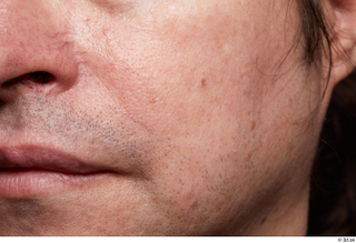 HD Face Skin Kevin Sarmiento cheek face lips mouth skin…